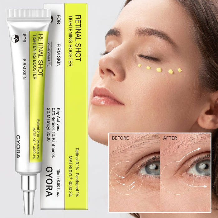 ¡DILE ADIOS A LAS OJERAS CON GYORA!